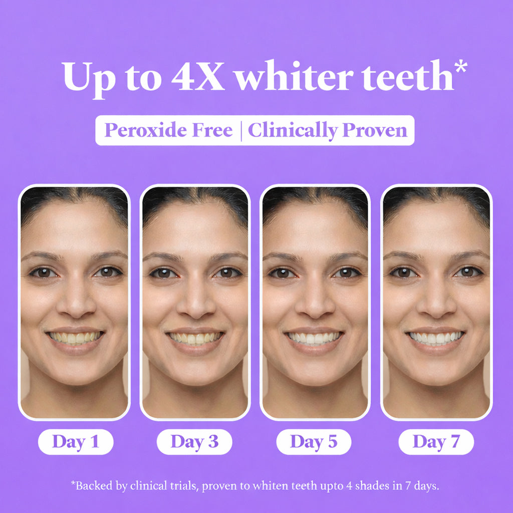 Sanfe Teeth Whitening Strips - 7 Pairs, For men & women