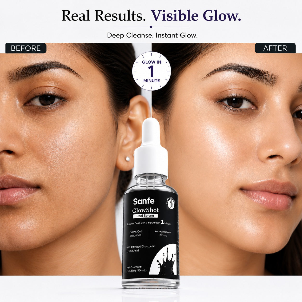 Sanfe GlowShot Peel Serum – 1-Minute Advanced Exfoliating Treatment