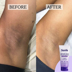 Sanfe Instant Tan & Dead Skin Removal Exfoliating Gel