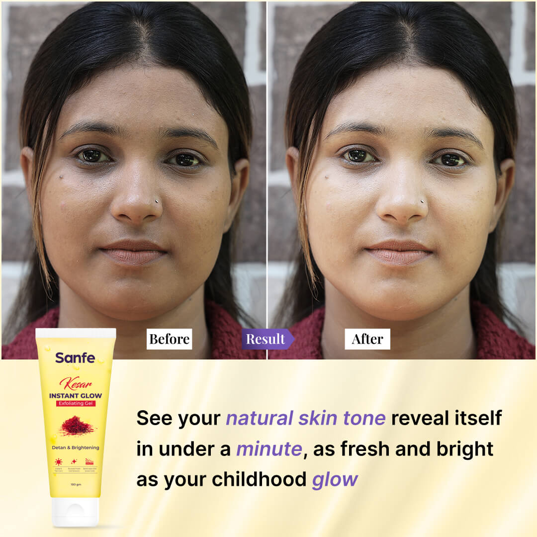Sanfe Kesar Instant Glow Exfoliating Gel